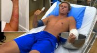 Australian surfer miraculously survives attack from âworldâs most venomous animalâ